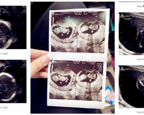 国内试管代怀医院,厦门正规做试管婴儿医院名单公布，3招教你如何选择放心机构